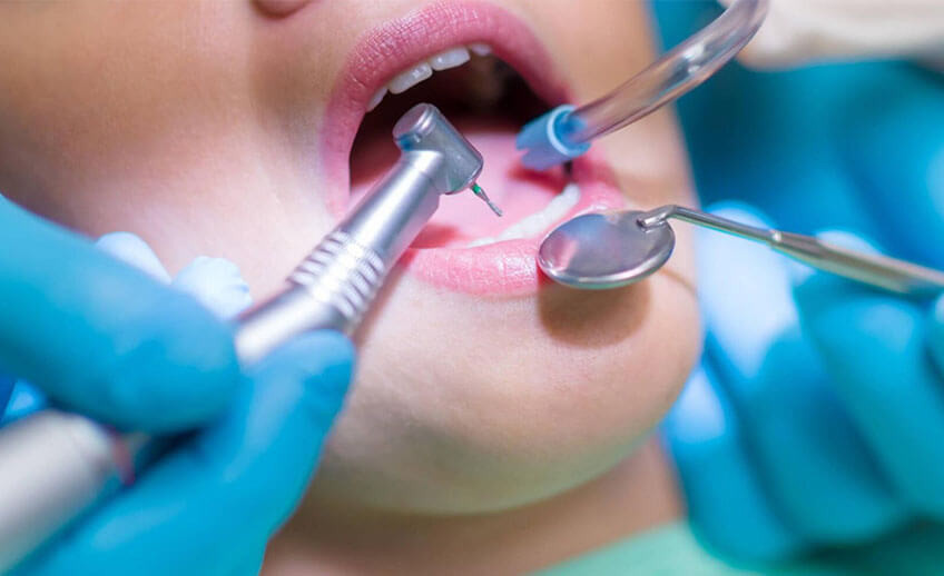 Restorative Treatment - Peachcroft Dental Surgery